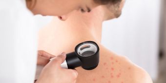 Allergy care must not be left to the NHS postcode lottery