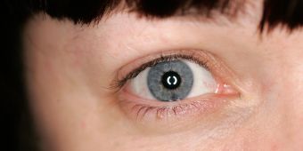 It's time we recognise eye health as an emergency – we need a national strategy