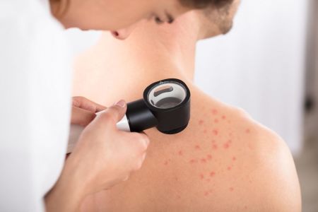 Allergy care must not be left to the NHS postcode lottery
