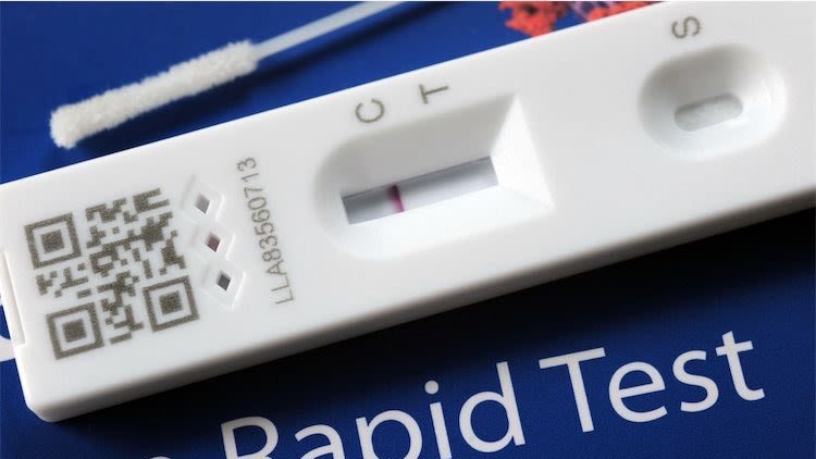 Government Temporarily Suspends PCR Tests To Confirm A Positive Lateral Flow Result