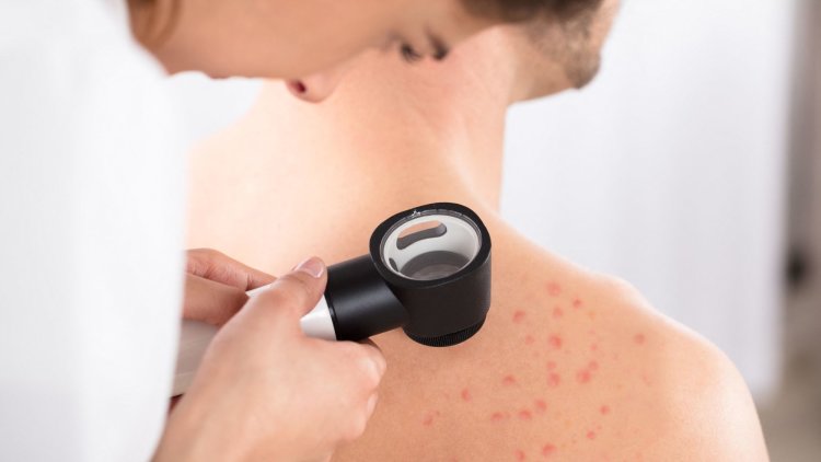 Allergy care must not be left to the NHS postcode lottery