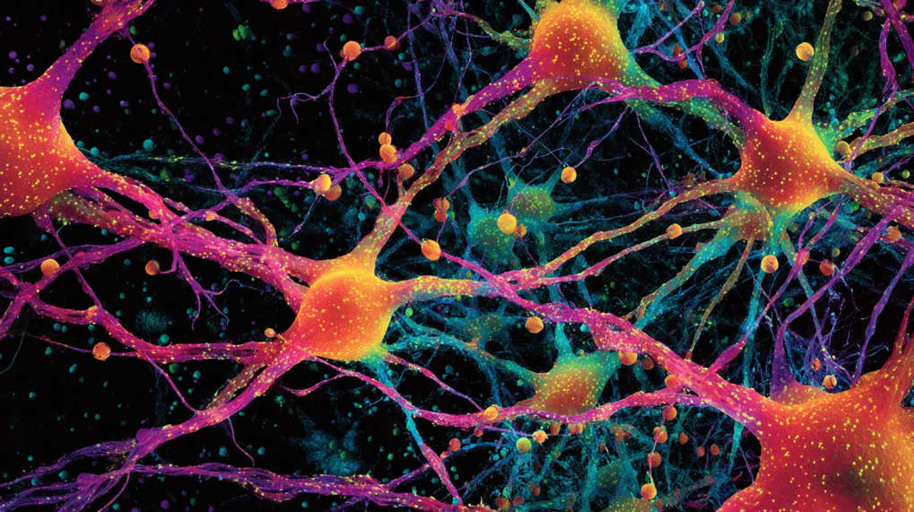 Read Article: Brain Health