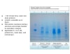 UPCK Urine Protein Enrichment / Concentration Kit - Image 2 of 0