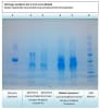 UPCK Urine Protein Enrichment / Concentration Kit - Image 4 of 0