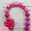 20mm Hot Pink Crackle Bubblegum Bead - Image 3 of 0