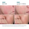SkinCeuticals Phyto Corrective Essence Mist | 50ml - Image 4 of 0