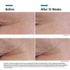 photo of SkinCeuticals P-Tiox | 30ml - Image 4 of 0