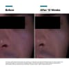 photo of SkinCeuticals P-TIOX Anti-Wrinkle Cream | 48ml - Image 4 of 0