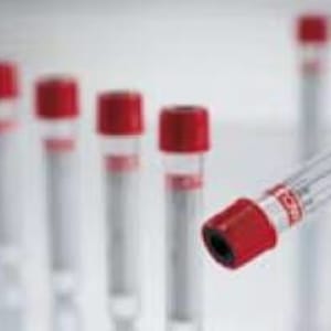 Greiner Bio-One VacuetteÂ® Z Serum Sep Clot Activator Venous Blood Collection Tube, 8 mL