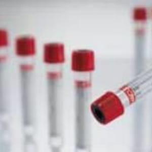 Greiner Bio-One VacuetteÂ® Z Serum Clot Activator Venous Blood Collection Tube, 9 mL, 16 x 100 mm