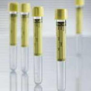 Greiner Bio-One VacuetteÂ® Urinalysis Tube, 6 mL, 13 x 100 mm
