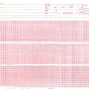 Nissha Medical Tech Recording Chart Paper Burdickâ„¢ Roll Red Grid