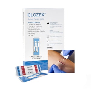 Clozex Medical Inc Skin Closure Device ClozexÂ® 1-1/2 X 2 Inch Polyurethane, Polyester, Medical Grade Acrylic Interlaced Closure Strip Clear