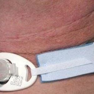 Sun Med AirLifeÂ® Tracheostomy Tube Holder