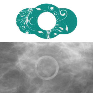 PDC Healthcare Radiology Skin Marker Spee-D-Lineâ„¢ Swirl Collectionâ„¢ Circle Mole