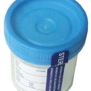 Starplex Scientific Corp Specimen Container LeakBusterâ„¢ 48 mm Opening 90 mL (3 oz.) Screw Cap Patient Information OR Sterile