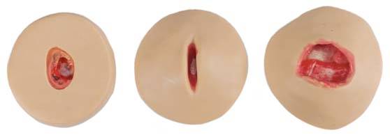 Nasco Life/form® Negative-Pressure Wound Therapy (NPWT) Trainers