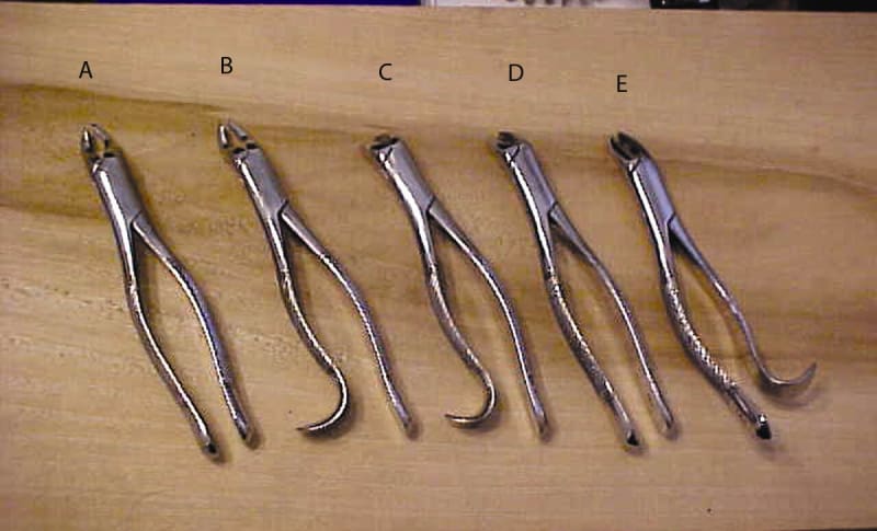 BB 110S Upper Molars ; Universal (A)