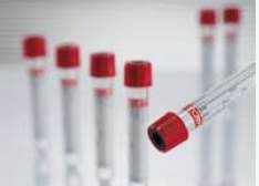 Greiner Bio-One VacuetteÂ® Z Serum Clot Activator Venous Blood Collection Tube, 9 mL, 16 x 100 mm