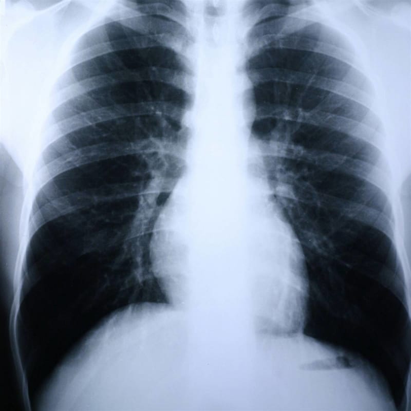 McKesson Brand Clear Choiceâ„¢ Performance X-Ray Film