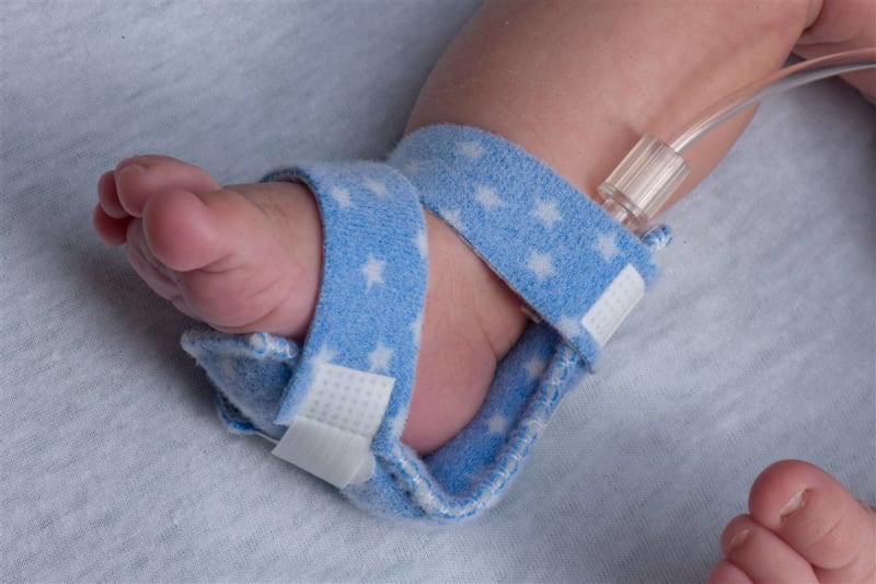 Dale Medical Products DaleÂ® Bendable IV Armboard, Extra Small
