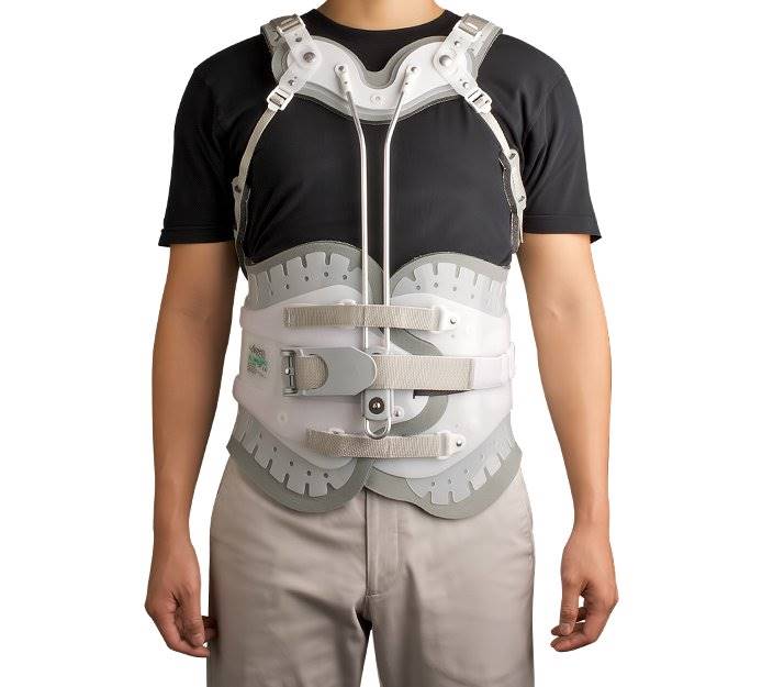 Aspen Medical Products Back Orthosis Horizonâ„¢ 456 TLSO One Size Fits Most Buckle Closure / Hook and Loop Closure 24 to 50 Inch Waist Circumference Adult Aspen Medical Products Back Orthosis Horizonâ„¢ 456 TLSO One Size Fits Most Buckle Closure / Hook and Loop Closure 24 to 50 Inch Waist Circumference Adult
