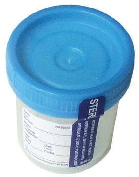 Starplex Scientific Corp Specimen Container LeakBusterâ„¢ 48 mm Opening 90 mL (3 oz.) Screw Cap Patient Information OR Sterile Starplex Scientific Corp Specimen Container LeakBusterâ„¢ 48 mm Opening 90 mL (3 oz.) Screw Cap Patient Information OR Sterile