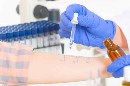allergy test