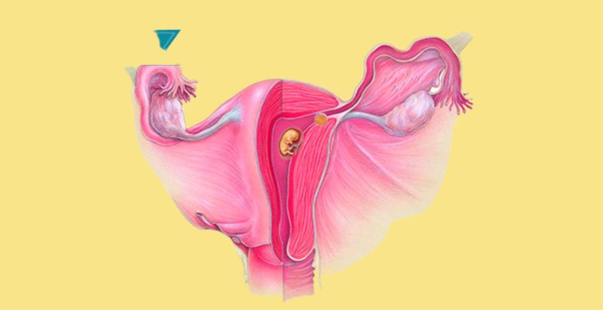 Implantation During Pregnancy