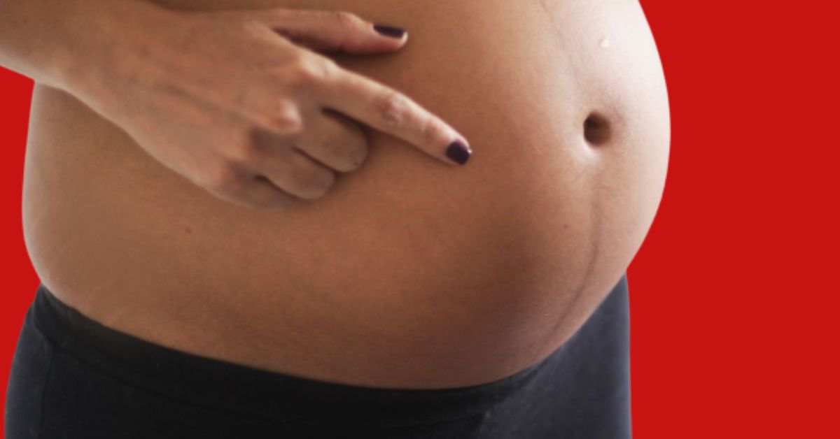 why-do-you-have-a-dark-belly-after-giving-birth