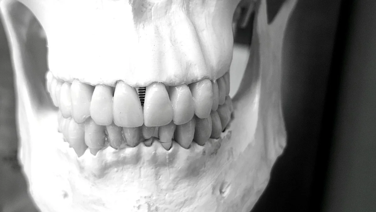 Vivani Medical announces implant progress at growth conference