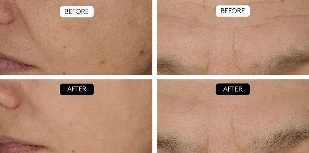 Exemples d'avant / après l'utilisation du produit