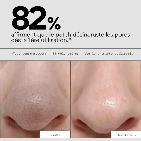 skin-and-out-patch-nez-avant-apres.webp