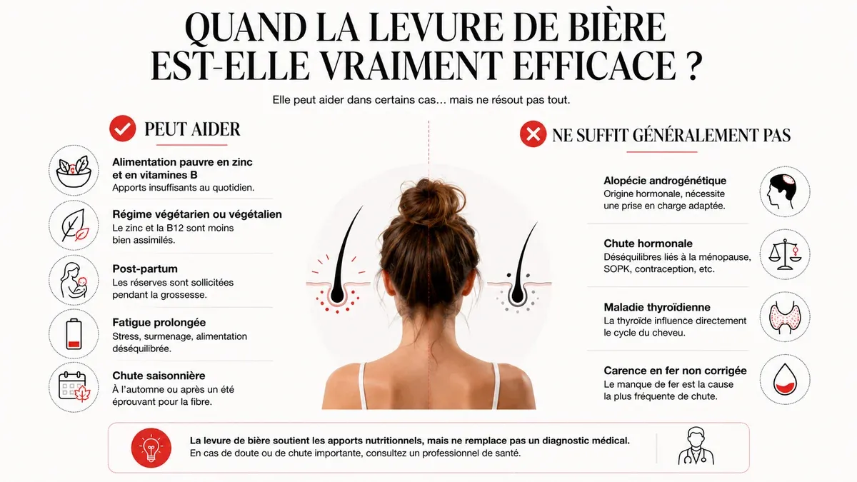 Infographie : Dans quels cas la levure de bière change vraiment quelque chose
