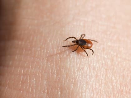 В Губахинском округе зафиксировали два случая клещевого боррелиоза
