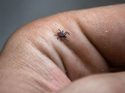 В Прикамье от укусов клещей пострадали более двух тысяч человек