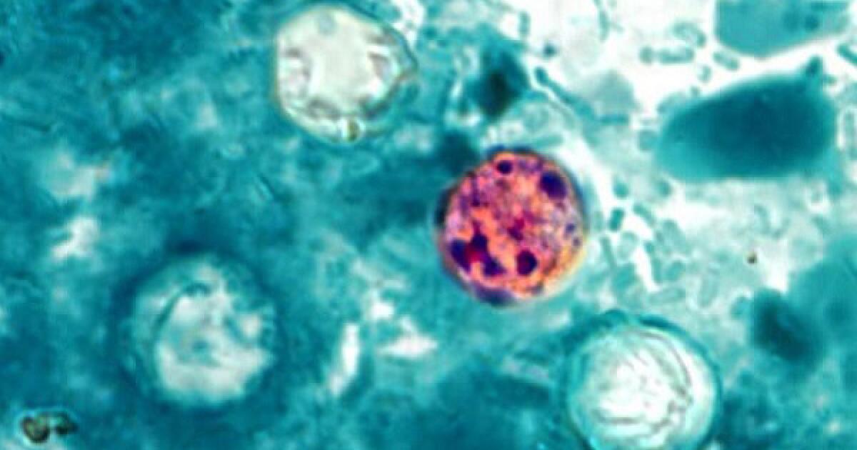 Cyclosporiasis Outbreak in the U.S.: California Residents Need to Be Aware