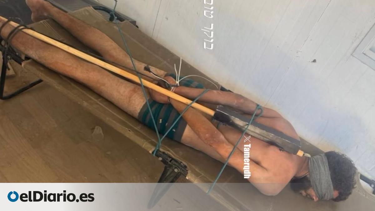 Israel Confirms Torture Allegations Against Palestinian Detainees in Gaza