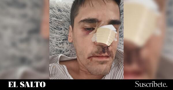 Periodista sufre agresión en Cádiz tras denunciar amenazas de extrema derecha