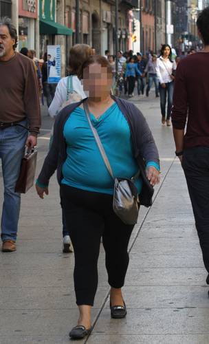 La obesidad como un problema sistémico que requiere políticas públicas integrales