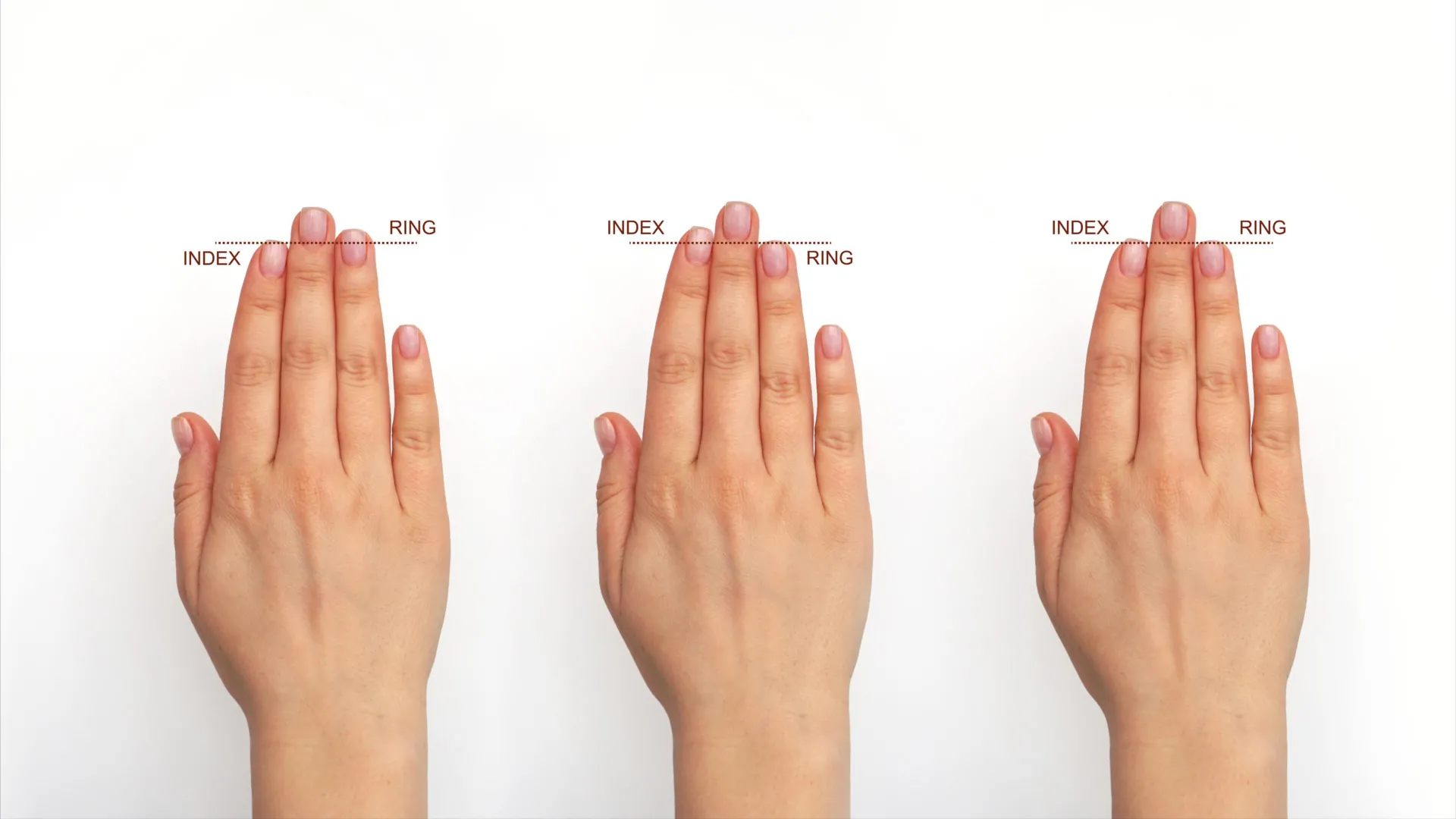 Prenatal Estrogen and Finger Lengths May Link to Human Brain Evolution