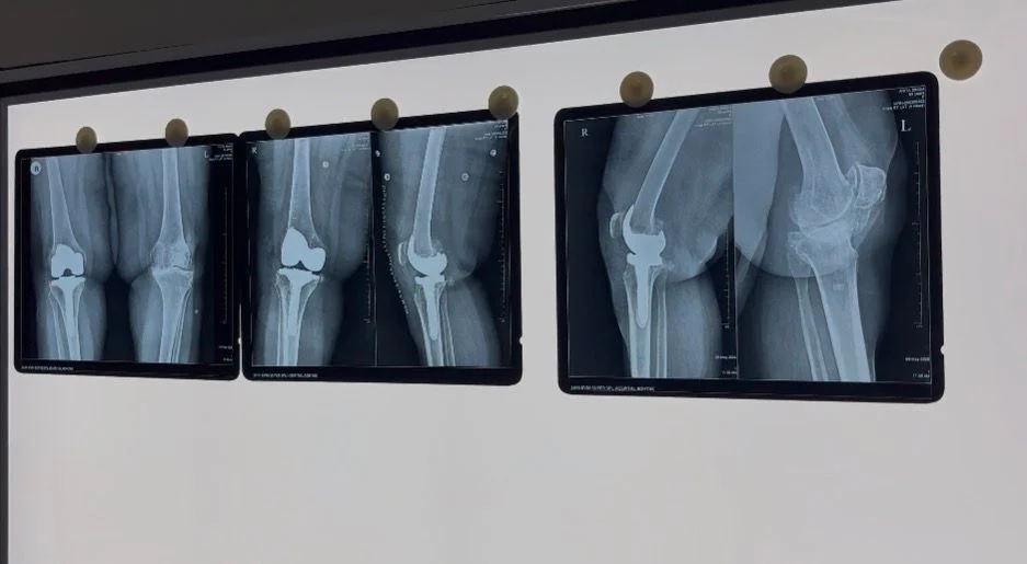 Advanced Ortho-Tech 1