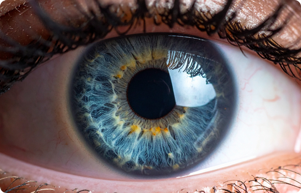 Total Ophthalmology Academy