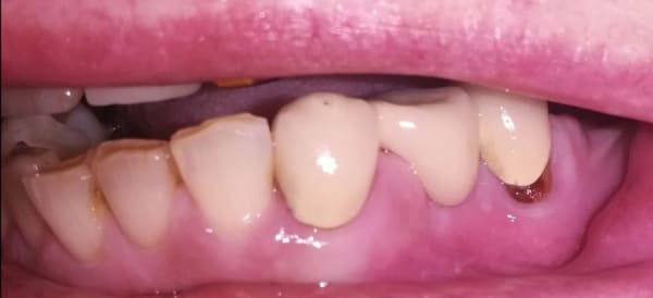 DentArt