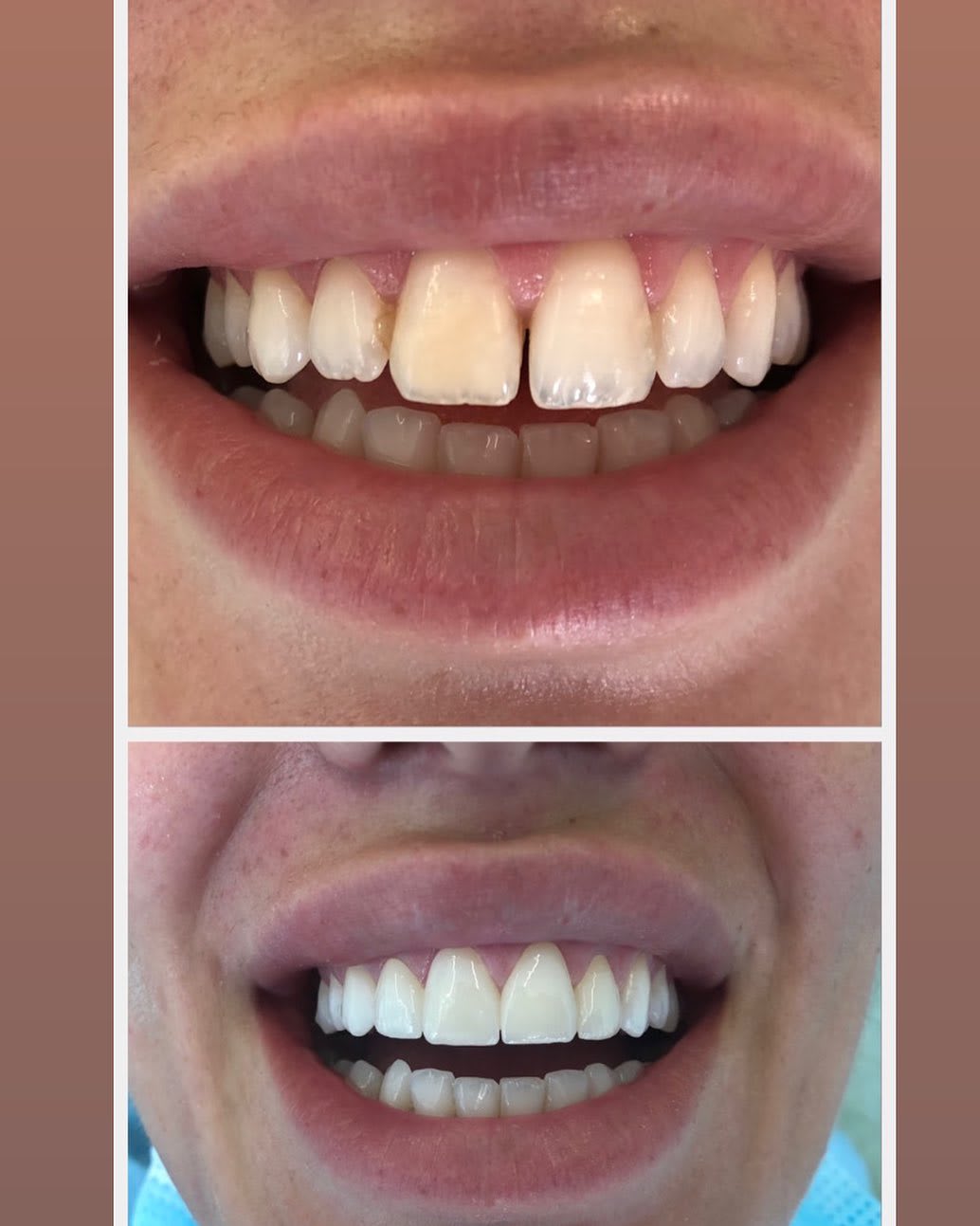 V Dental Centar photo 8
