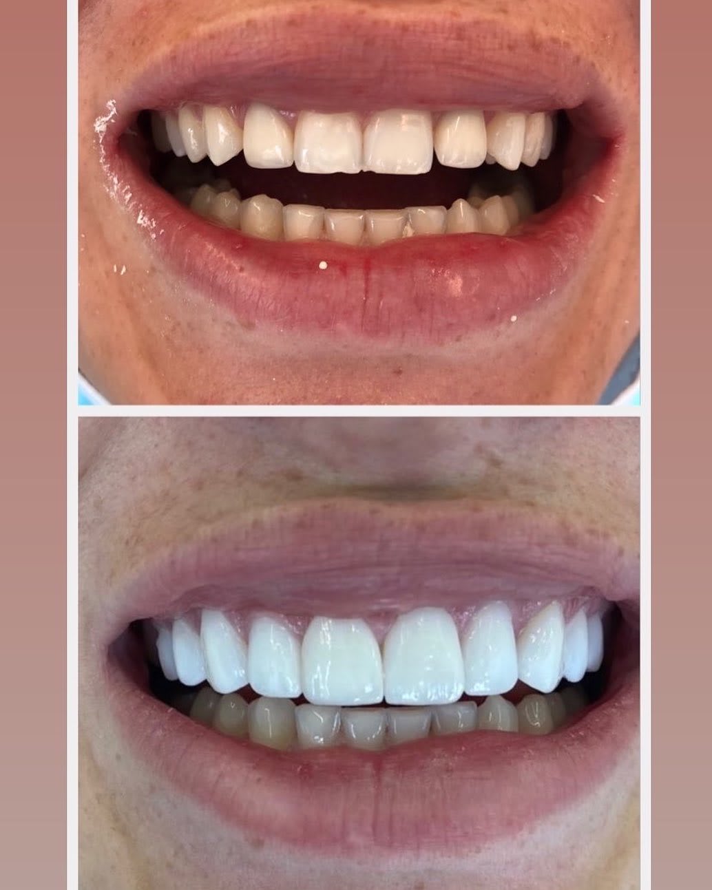V Dental Centar photo 9
