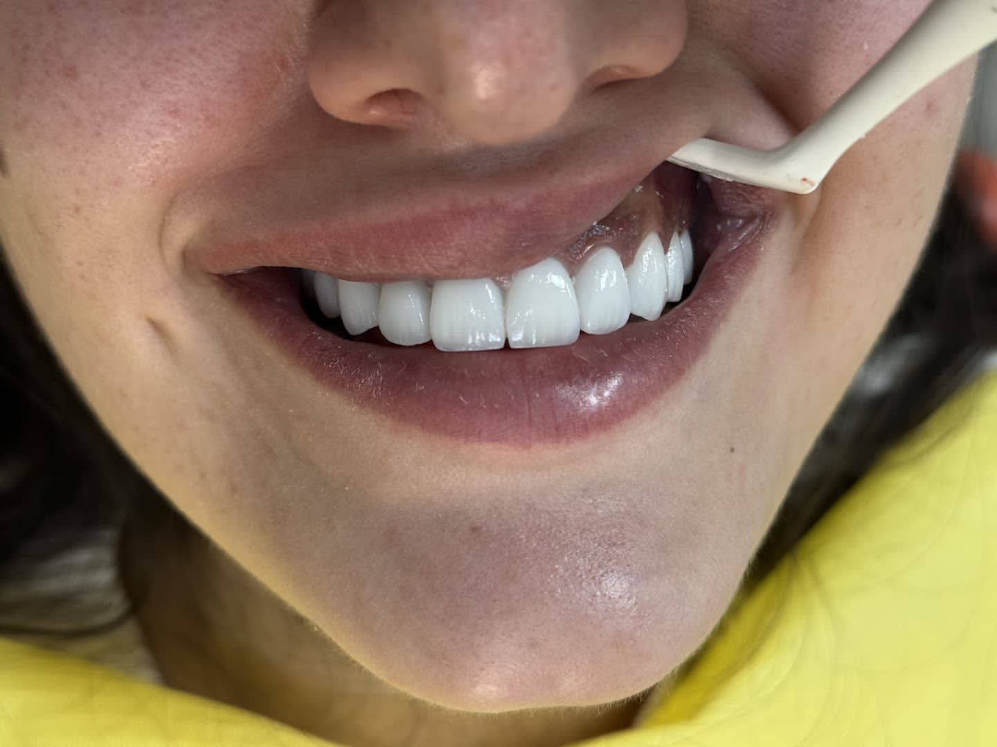 Stefanija Dental photo 6