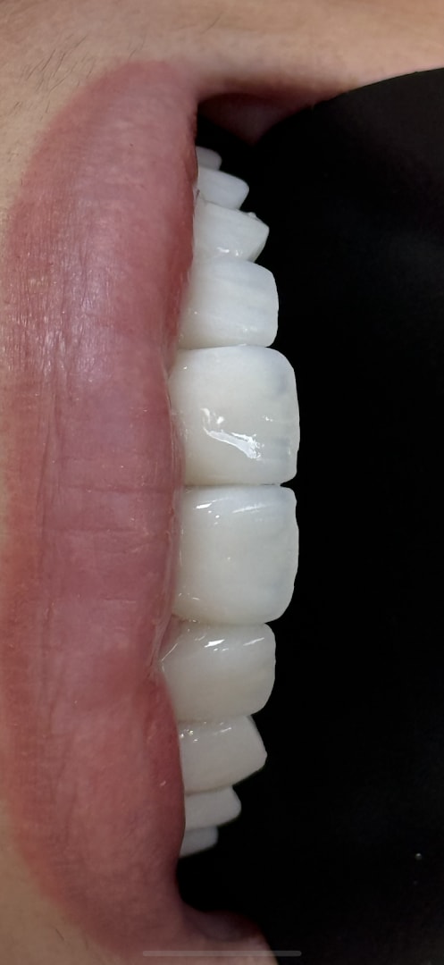 Stefanija Dental photo 7