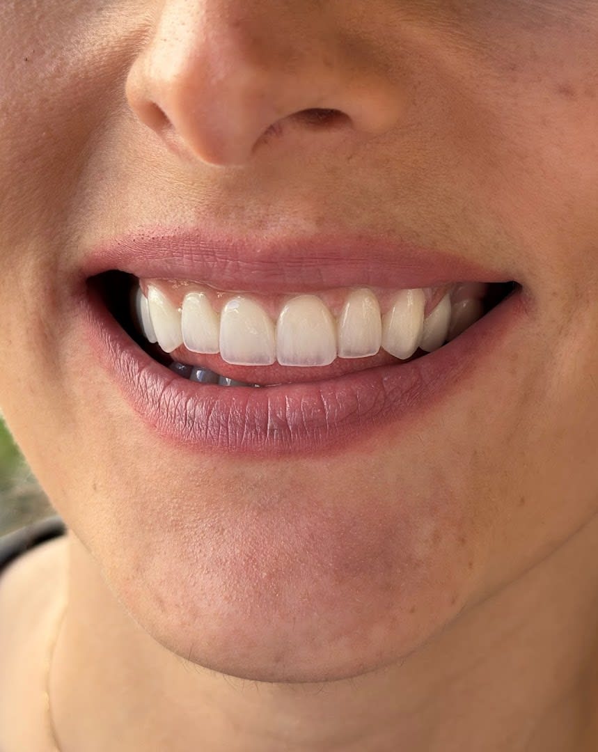 Stefanija Dental photo 8