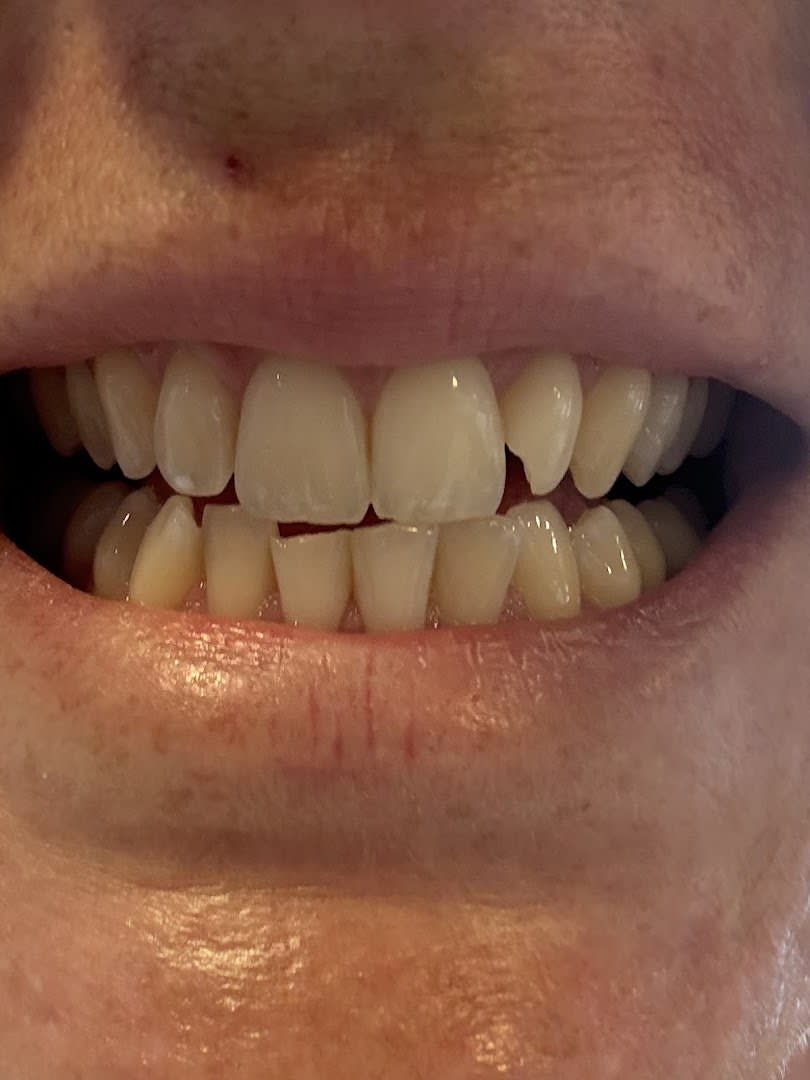 AB Dental Clinic Phuket photo 4